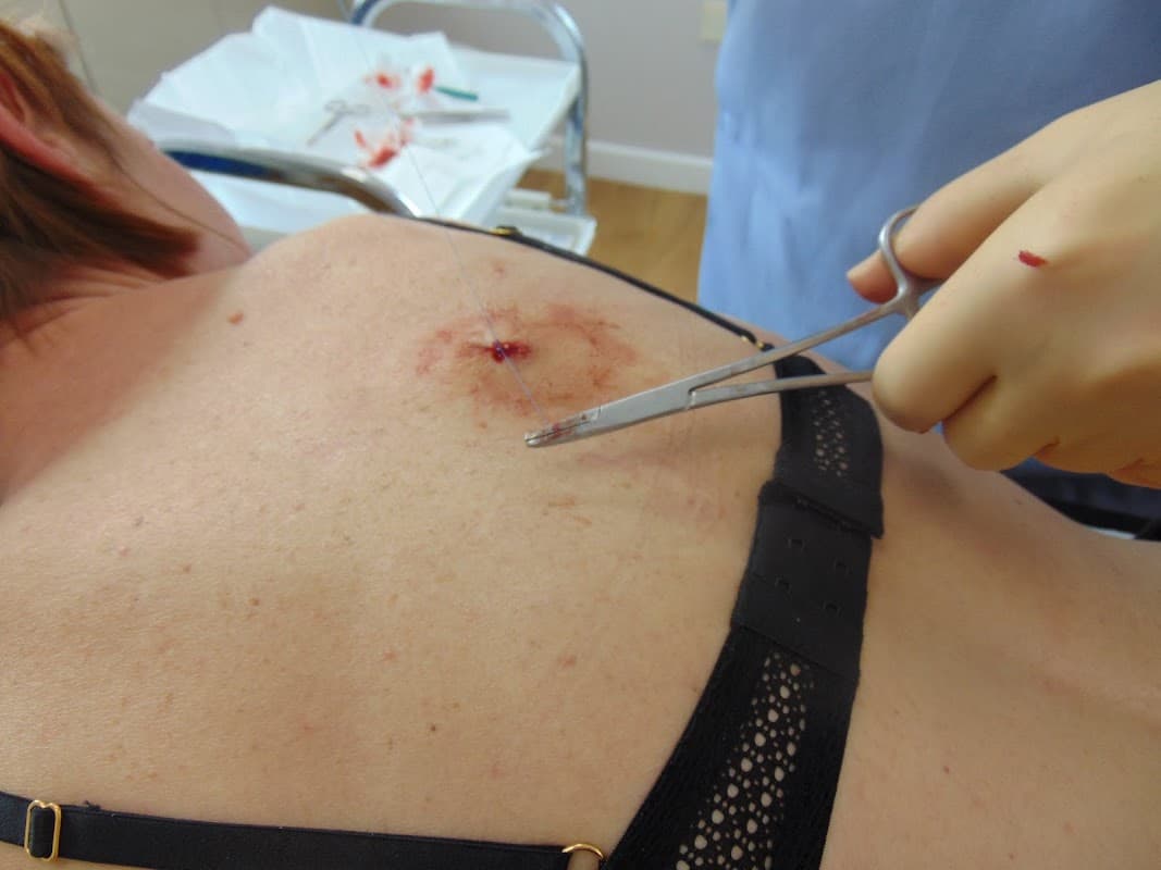 Decyst Clinic - Doctors in brough