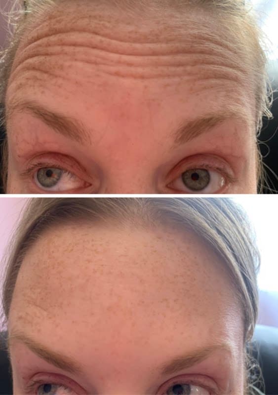 Ronita Aesthetics - Beauty Salons in brough