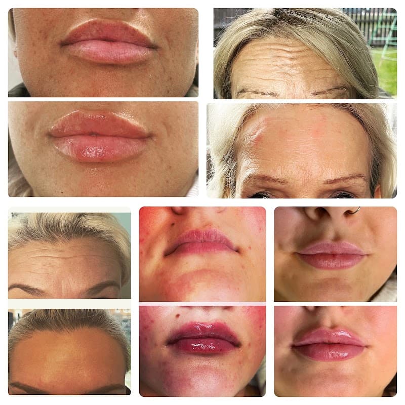 Perfect luxe aesthetics - Beauty Salons in catterick garrison