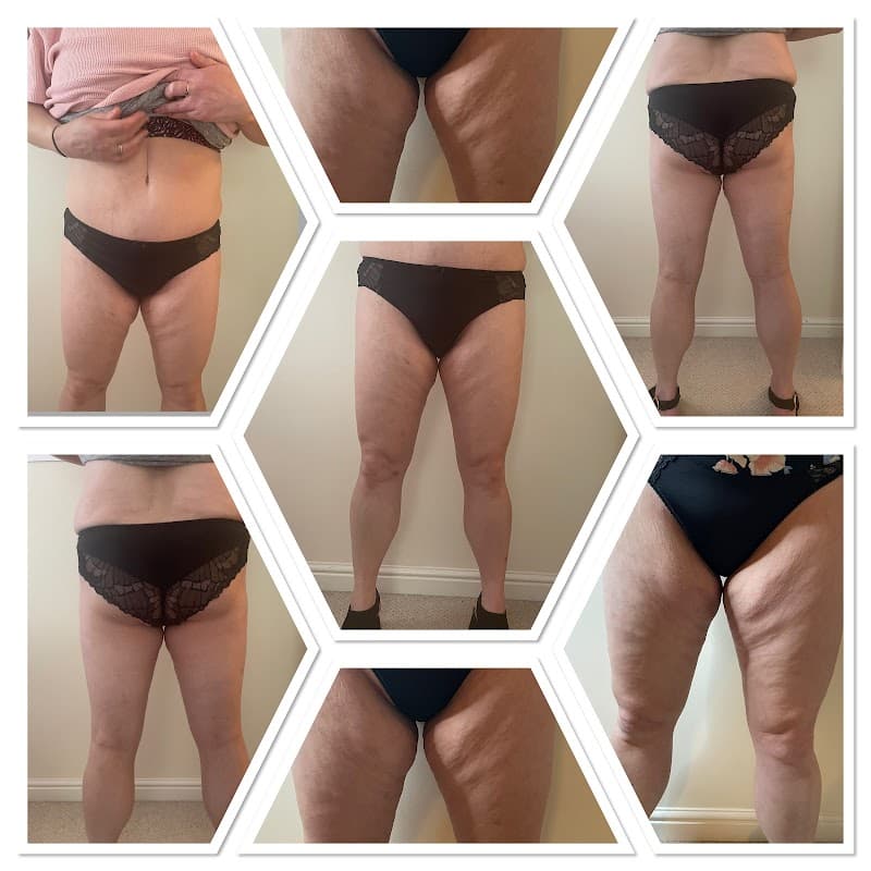 R&L Aesthetics Limited T/A Skinvestment - Beauty Salons in eckington