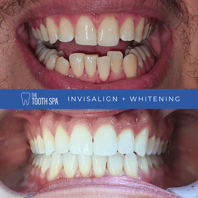 The Tooth Spa - Dentists in leeds