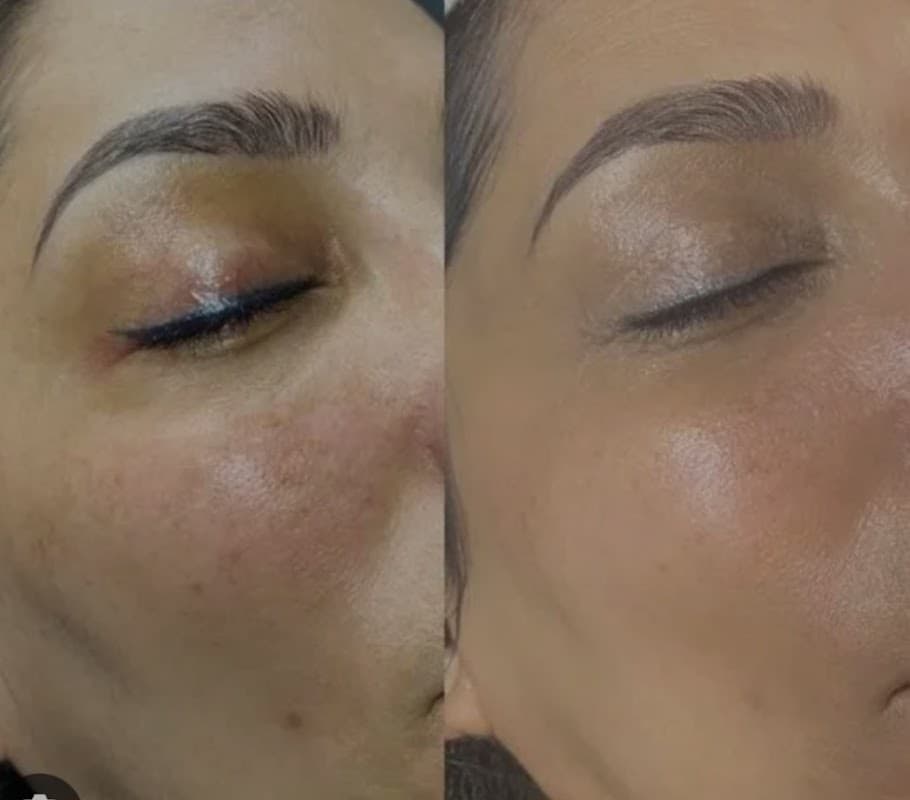 No7 Beauty Room - Spa in mexborough