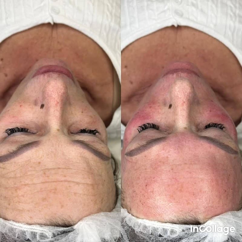 Aesthetics by Lara - Beauty Salons in ossett