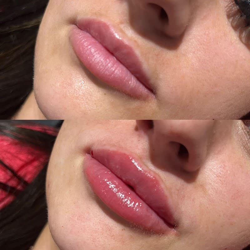 The Aesthetics Lounge - Beauty Salons in redcar